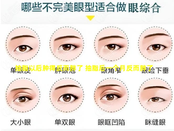 抽脂以后肿得反而胖了 抽脂后一个月反而胖了